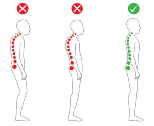 The Role of Chiropractic Care in Improving Posture and Spinal Health